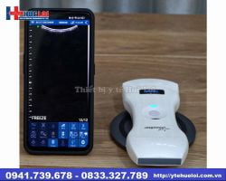 Máy siêu âm không dây tích hợp 3 đầu dò