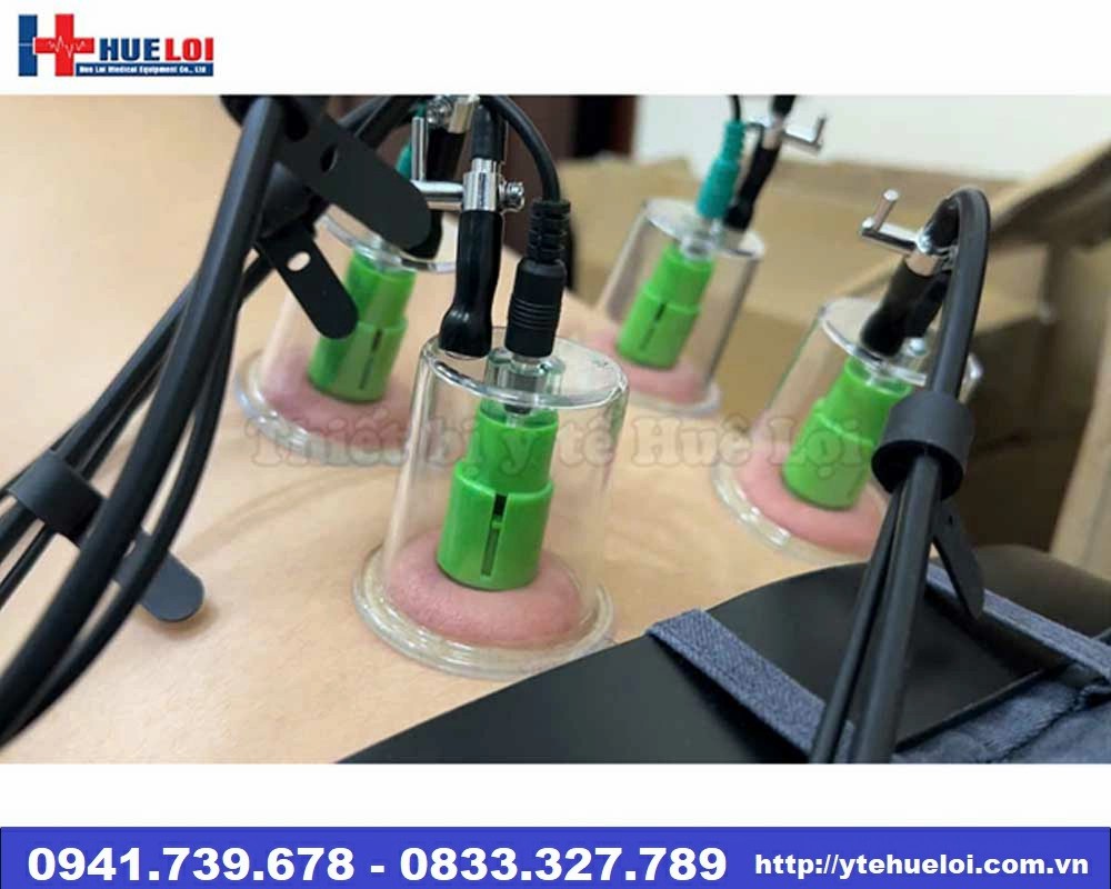 Máy điện châm không kim kèm giác hút