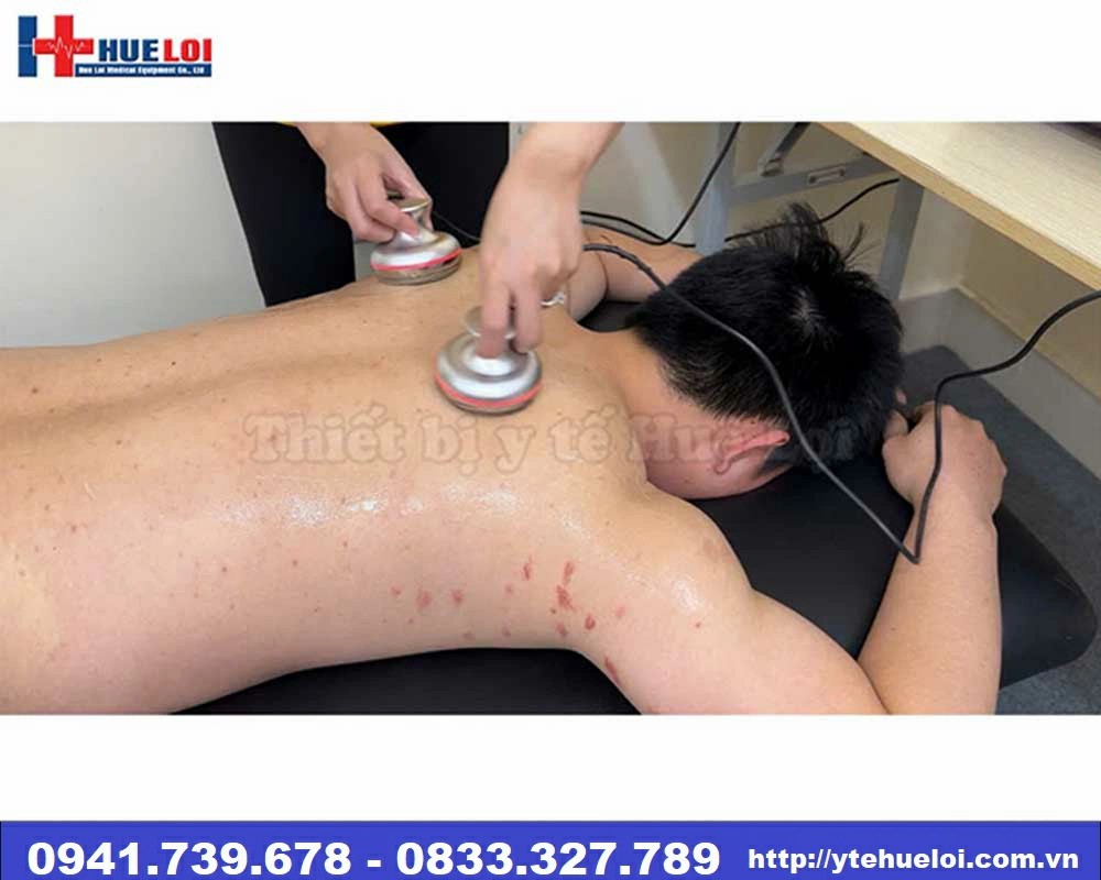 Máy điện châm không kim