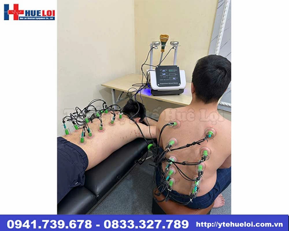 Máy điện châm không kim kèm giác hút