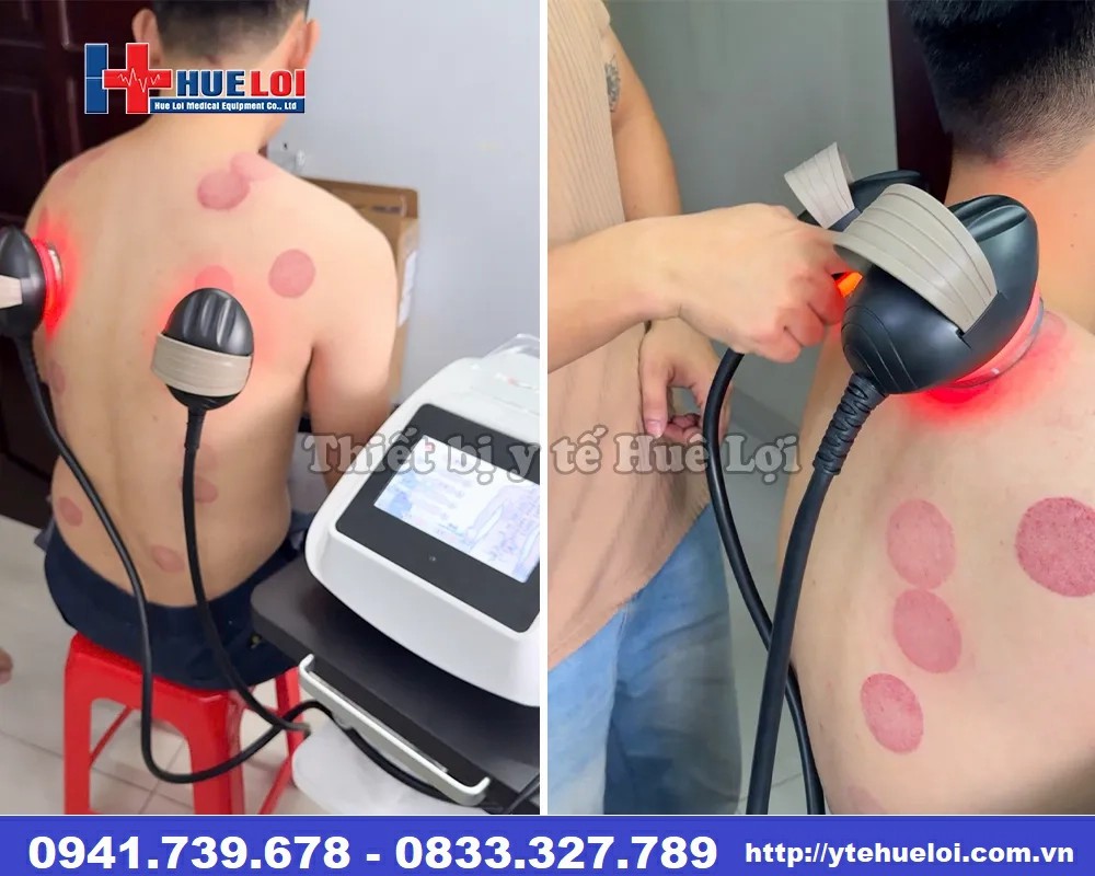 máy điện sinh học thế hệ mới