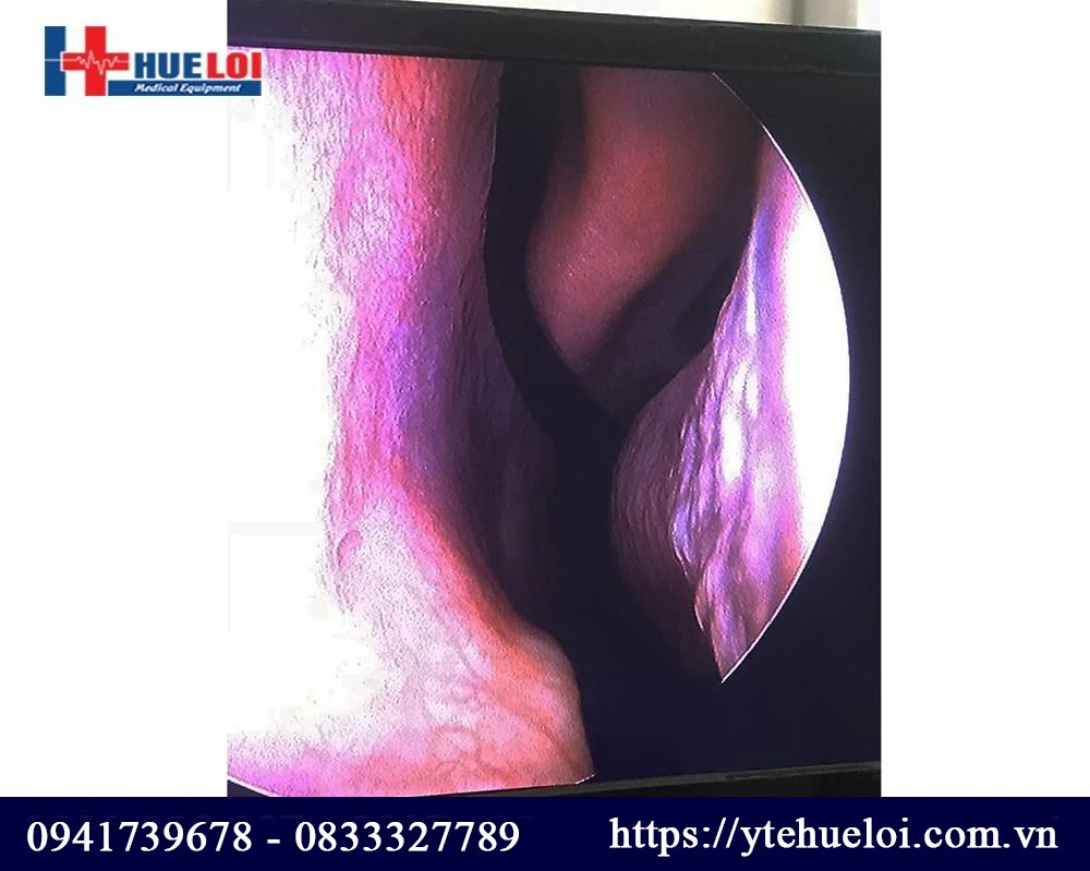 may-noi-soi-tai-mui-hong-5