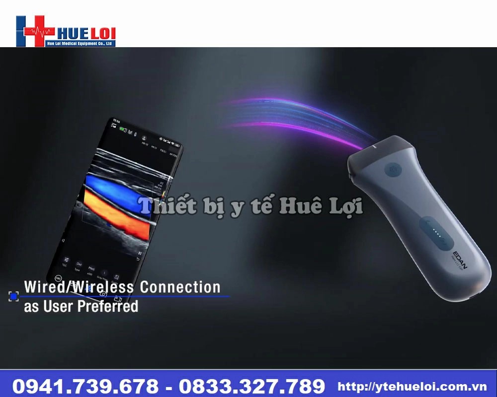 máy siêu âm cầm tay di động