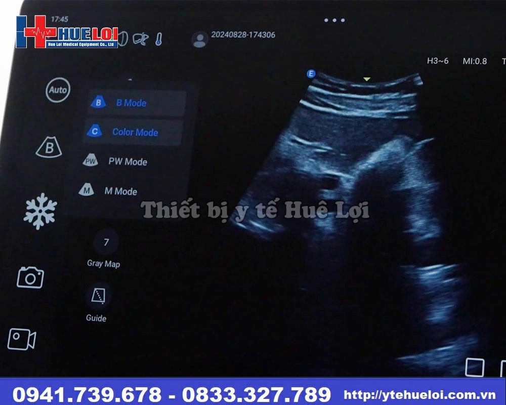 máy siêu âm cầm tay di động Nano L12 EXP