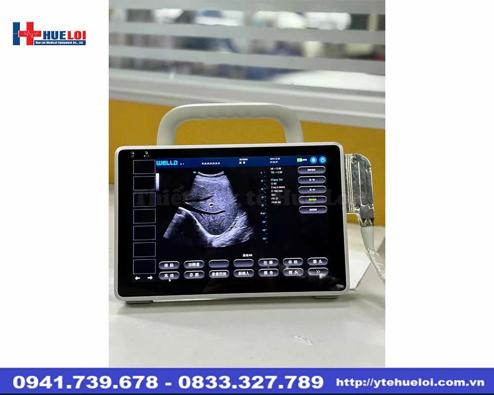 Máy siêu âm xách tay Doppler màu P10