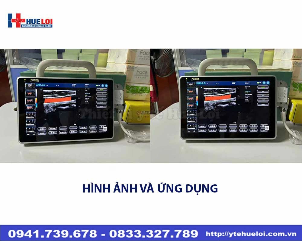 Máy siêu âm xách tay cảm ứng Well.D