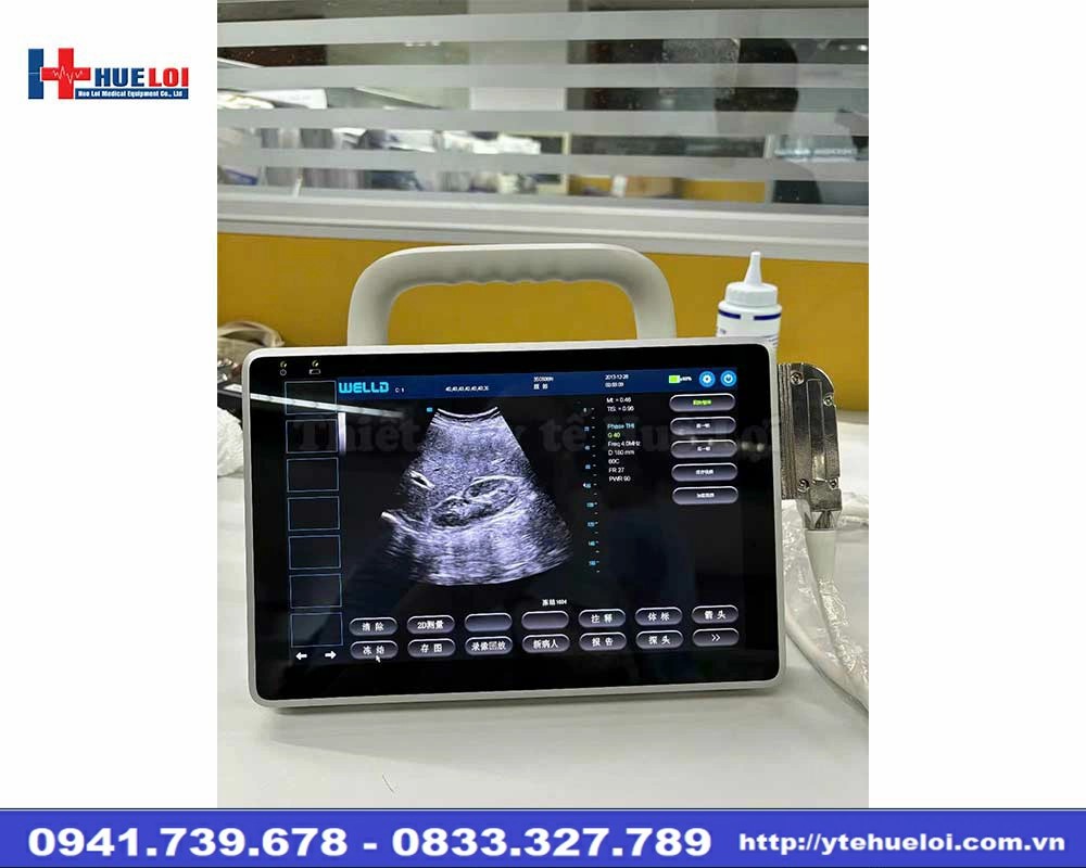 Máy siêu âm xách tay Doppler màu P10