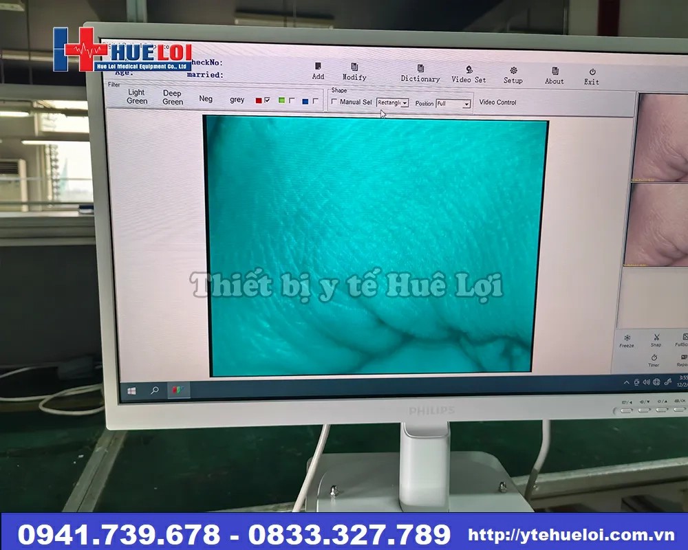 Máy soi cổ tử cung Full hd sw-304