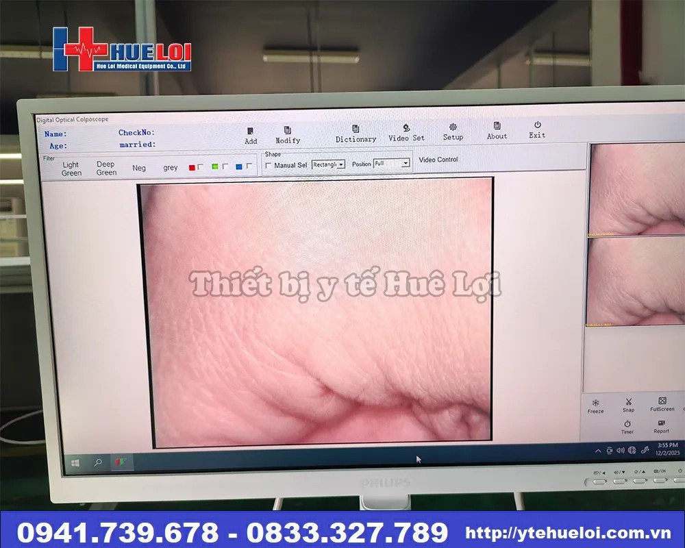 Máy soi cổ tử cung Full hd sw-304