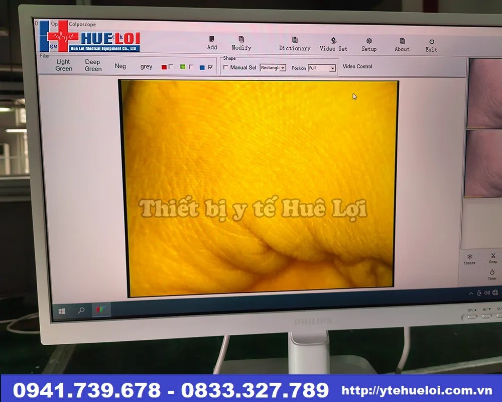 Máy soi cổ tử cung Full hd sw-304