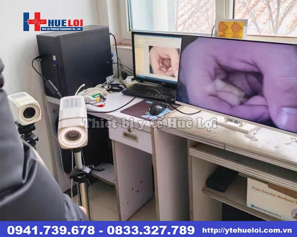 Máy chẩn đoán bệnh lý phụ khoa SD SW-304 