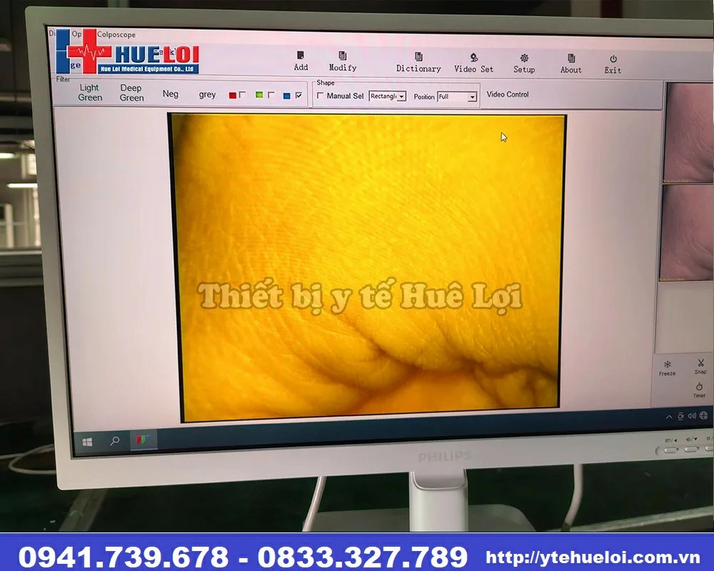 máy soi cổ tử cung