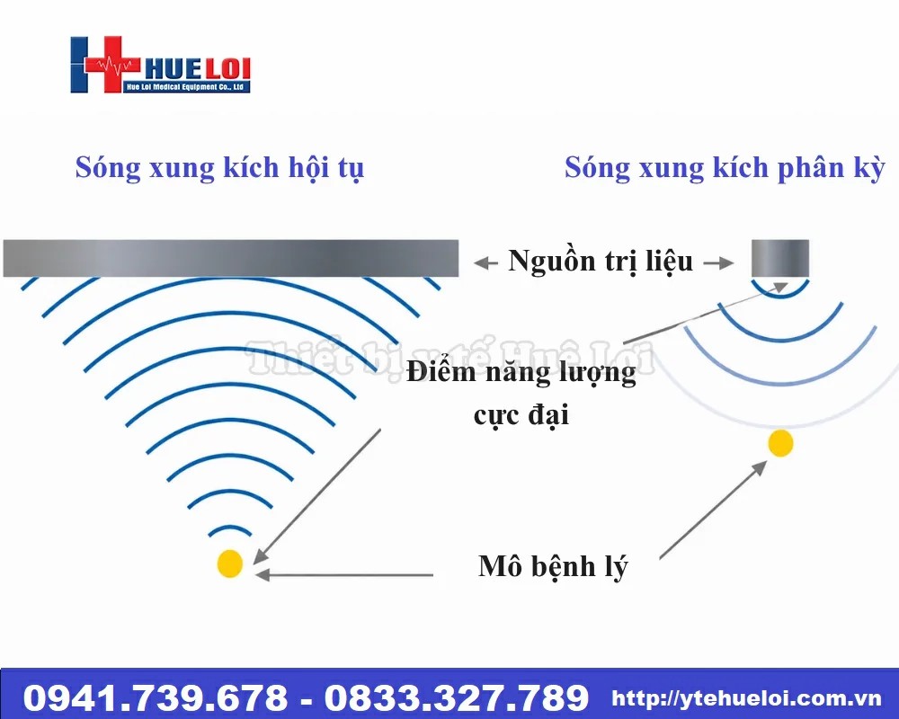 Máy điều trị bằng sóng xung kích